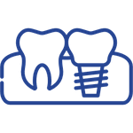 Lifetime Implant Guarantee