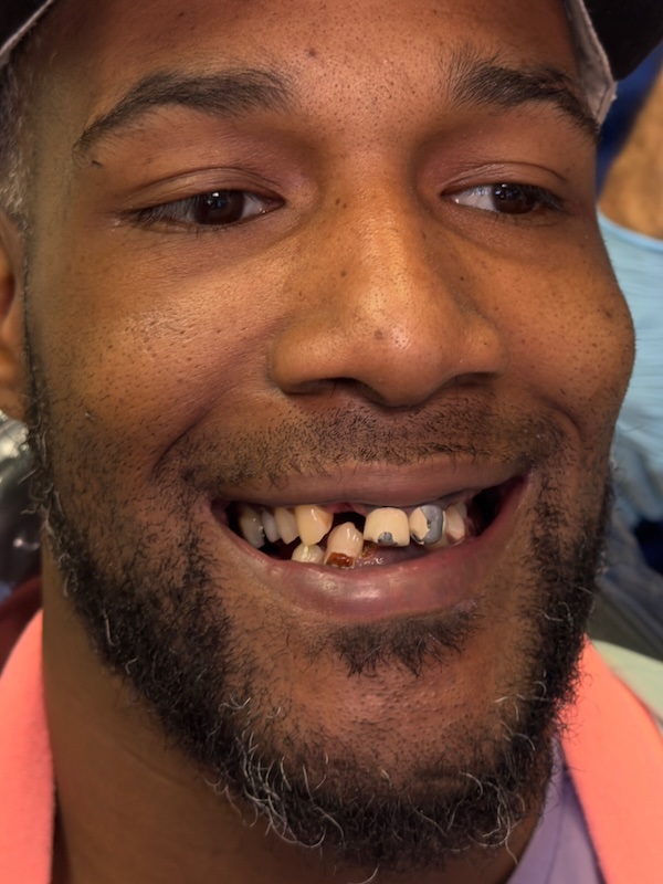Case 1 Before