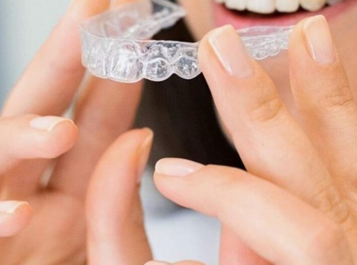 Are At-Home Teeth Aligners Safe?