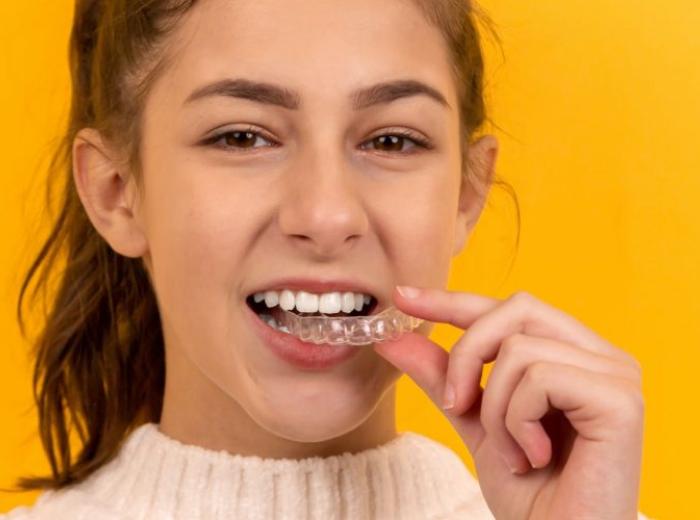 Veneers vs Invisalign: Which Is Better?