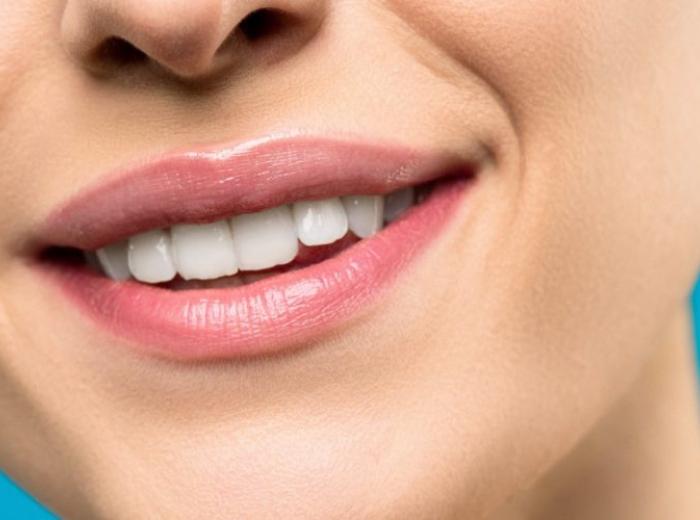 Zoom! Teeth Whitening