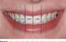 What to expect during brace treatment? The active phase