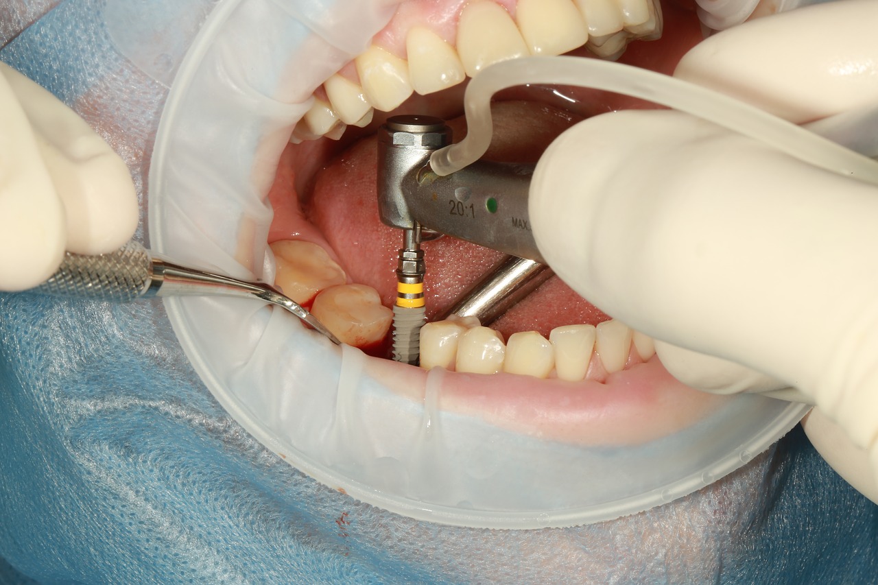 patient undergoing dental implant surgery