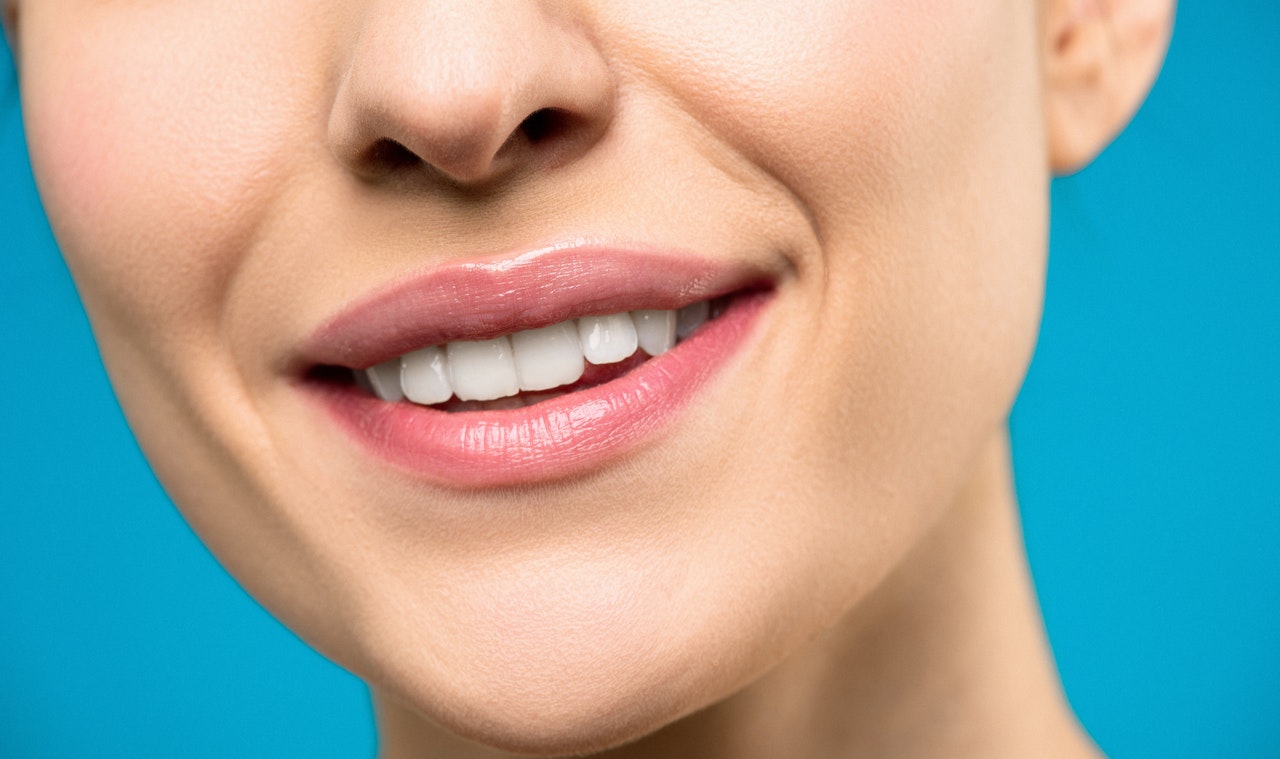 woman posing for a photo with bright white smile