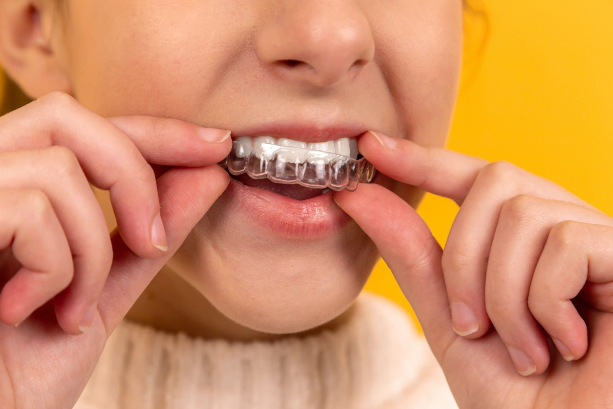 A young girl trying to wear a mouth guard