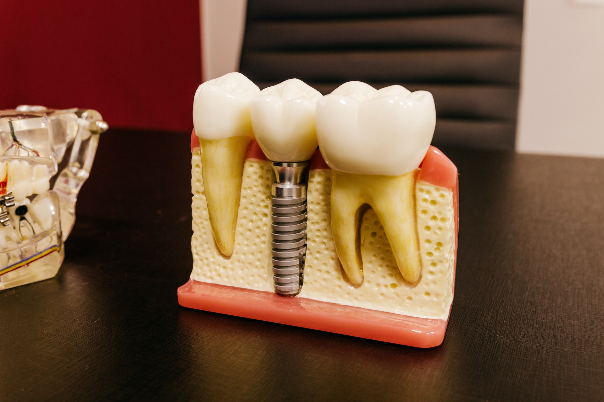 Close up of a dental implant