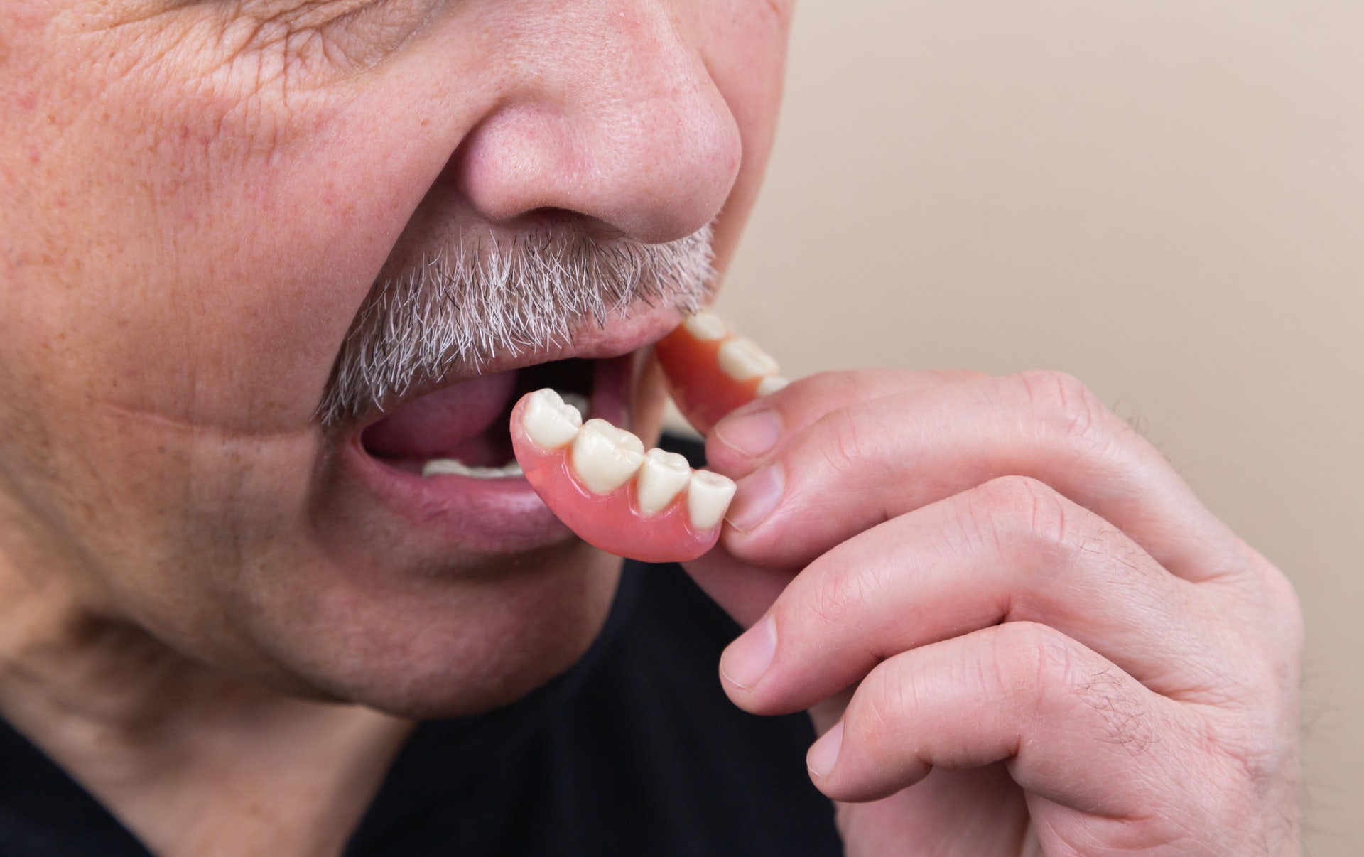 An older man puts in his complete dentures