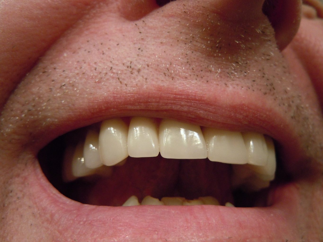 An up-close view of a man’s teeth