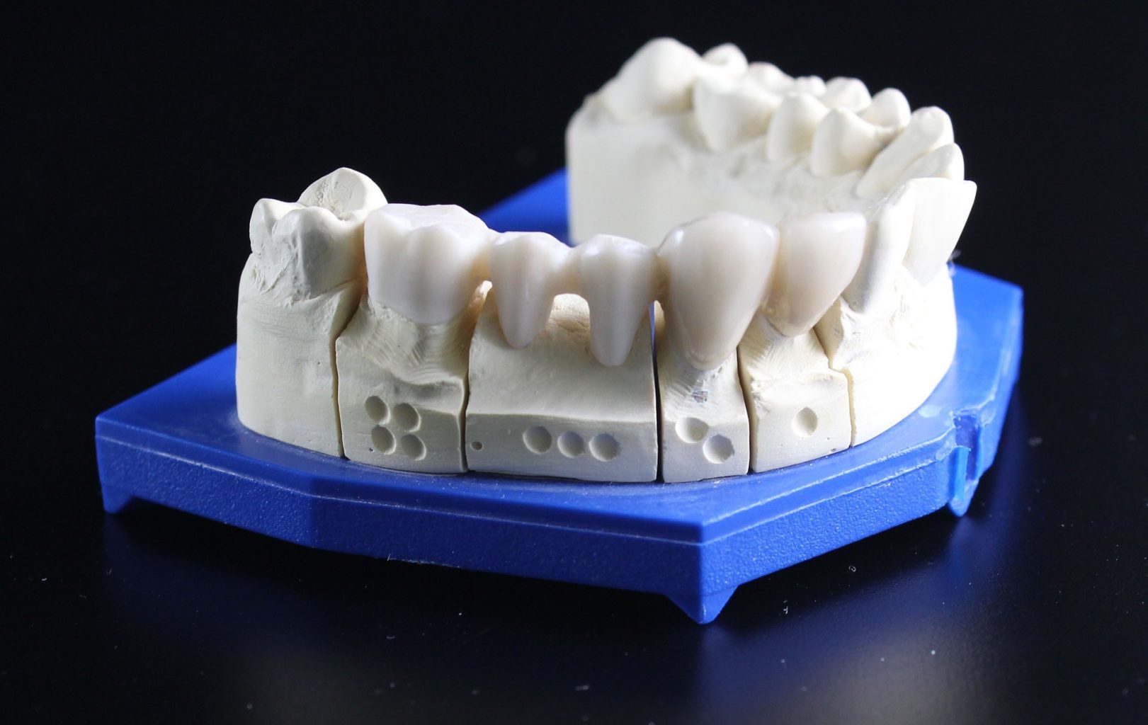 A dentures model