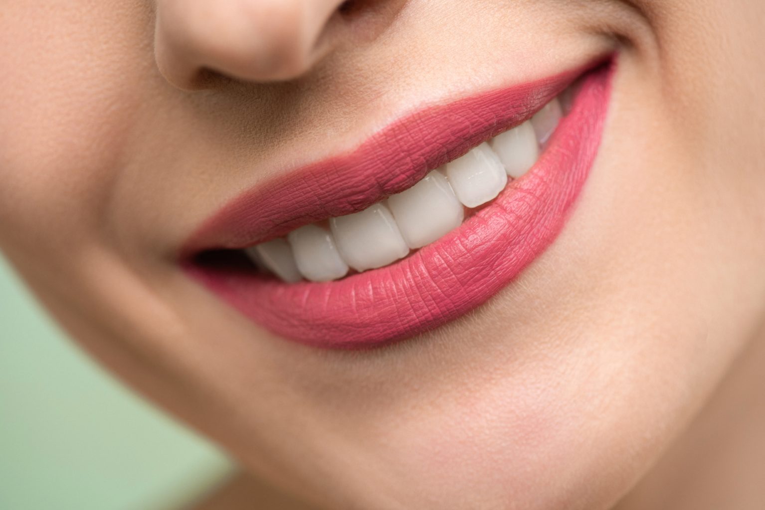  A woman with aligned smiling