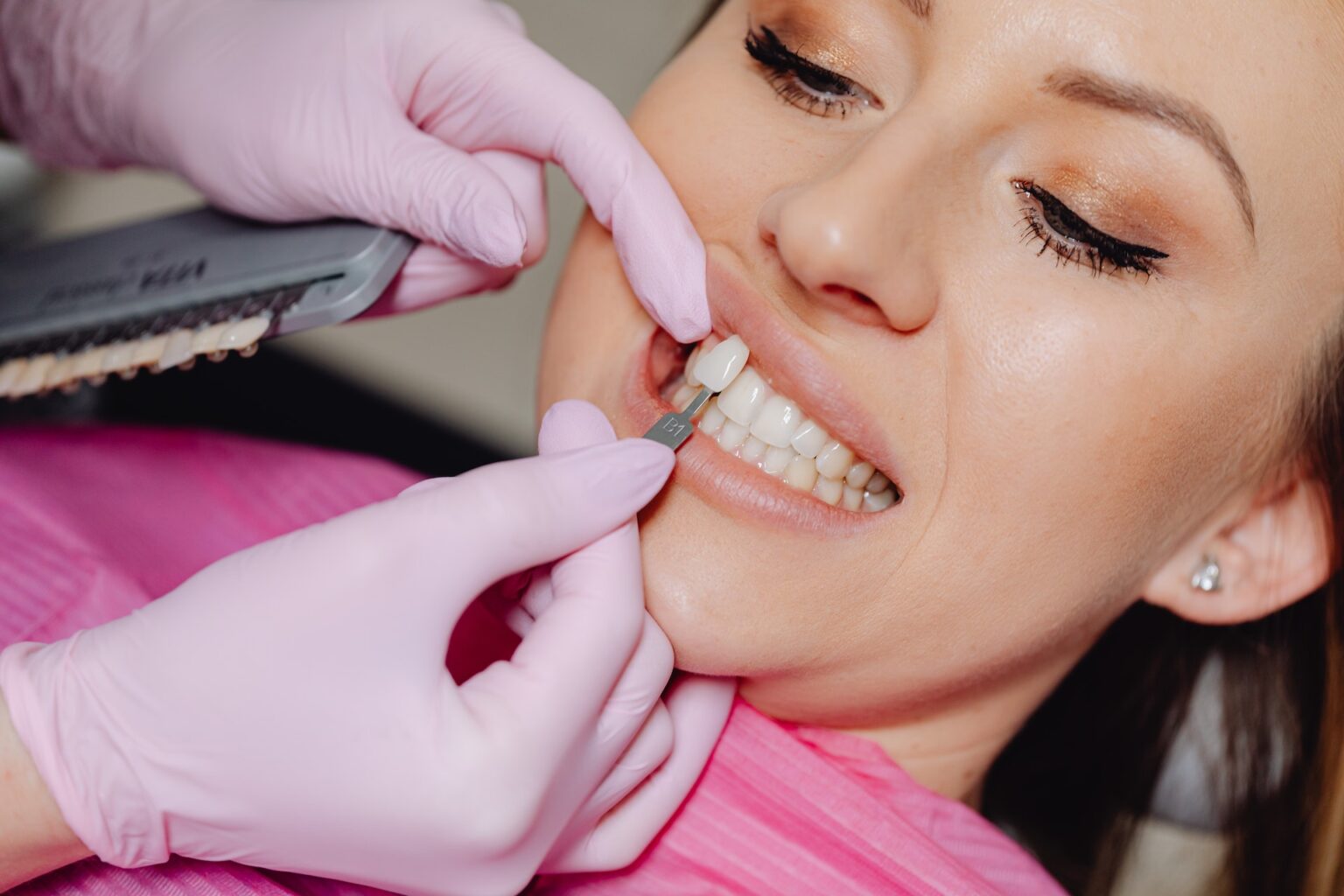 A dentist matching a dental veneer to a patient’s tooth