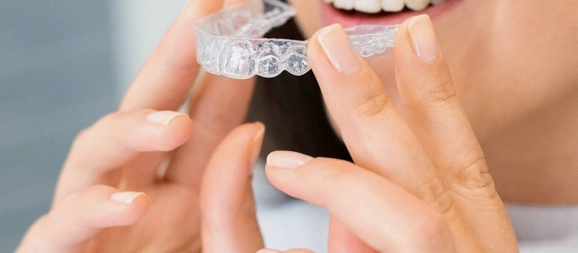 A woman holding a clear aligner