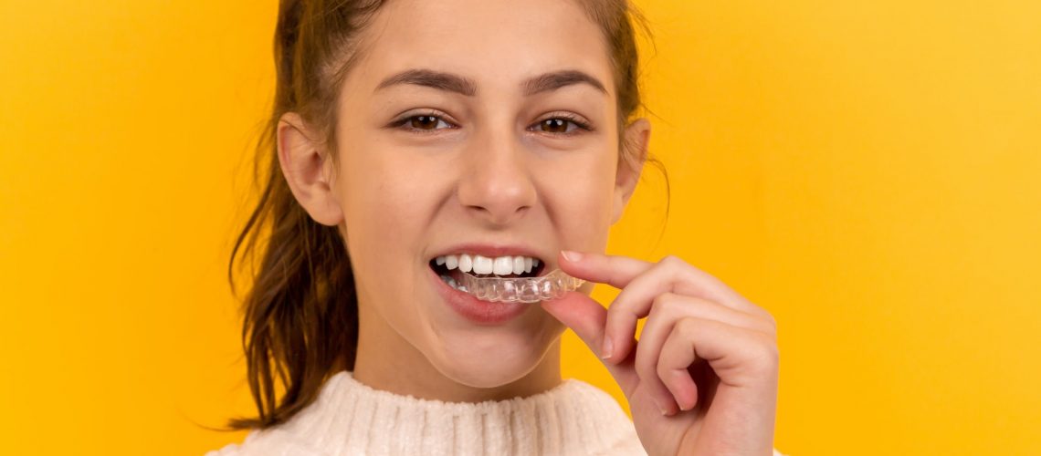 A girl putting in a clear retainer for dental alignment