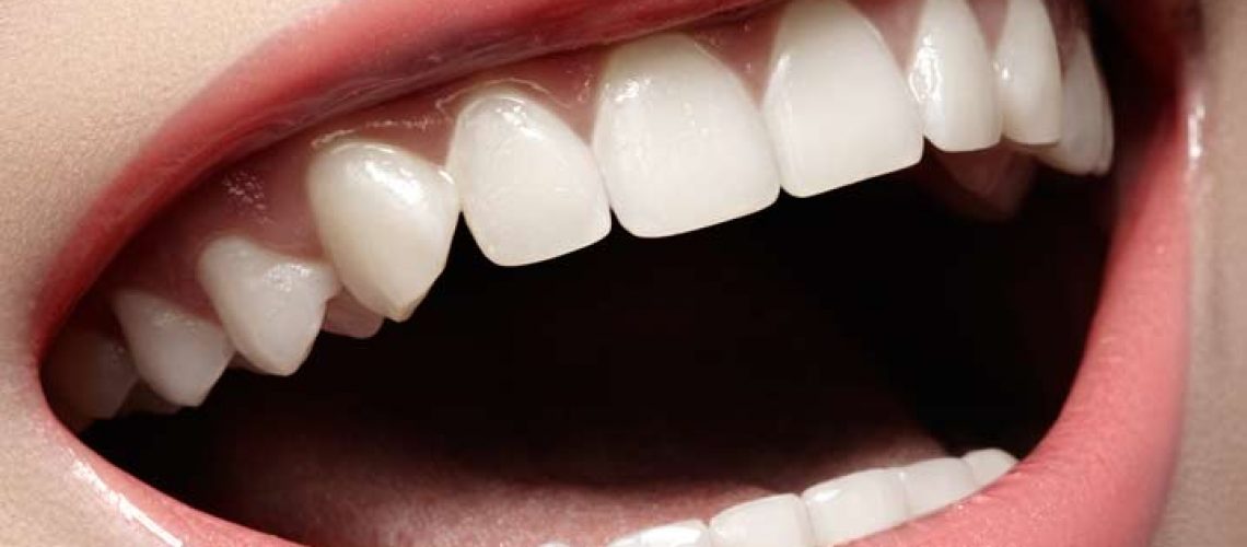 Can Dental Cleanings Damage Enamel? Definitive Dental