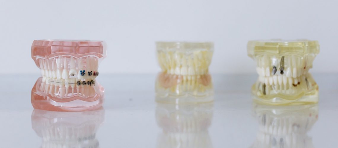 dentures model