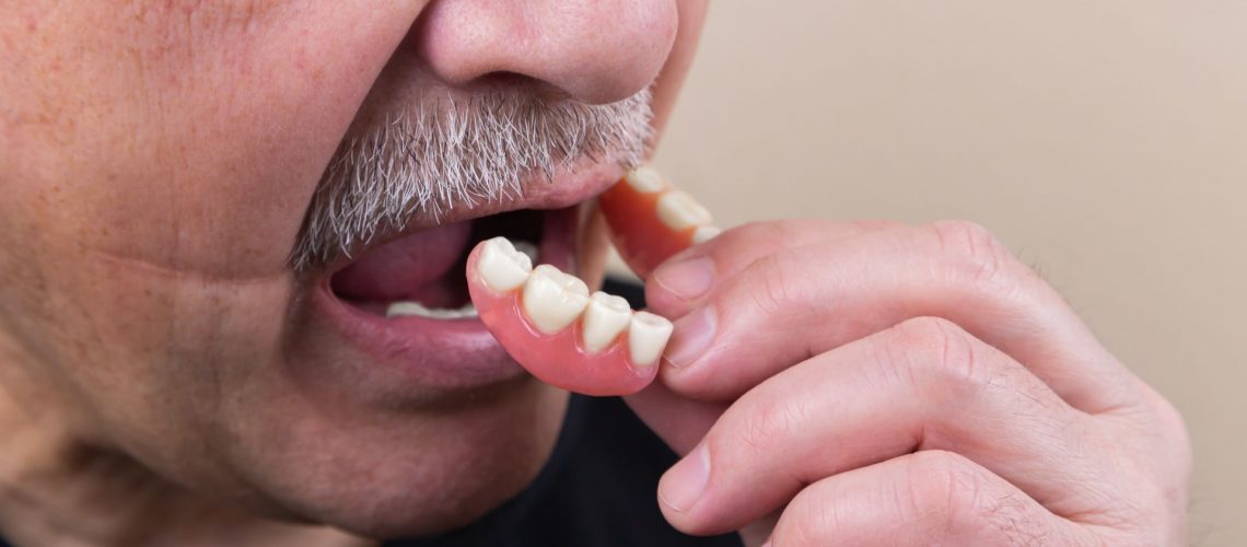 An older man puts in his complete dentures