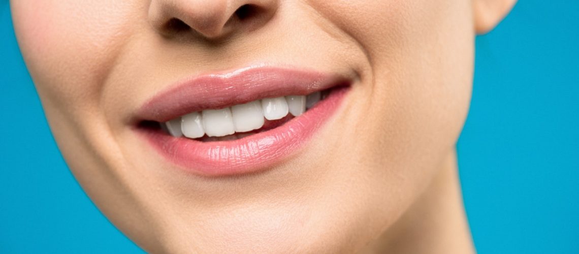 woman posing for a photo with bright white smile