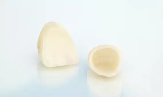 Why Are Dental Crowns Needed