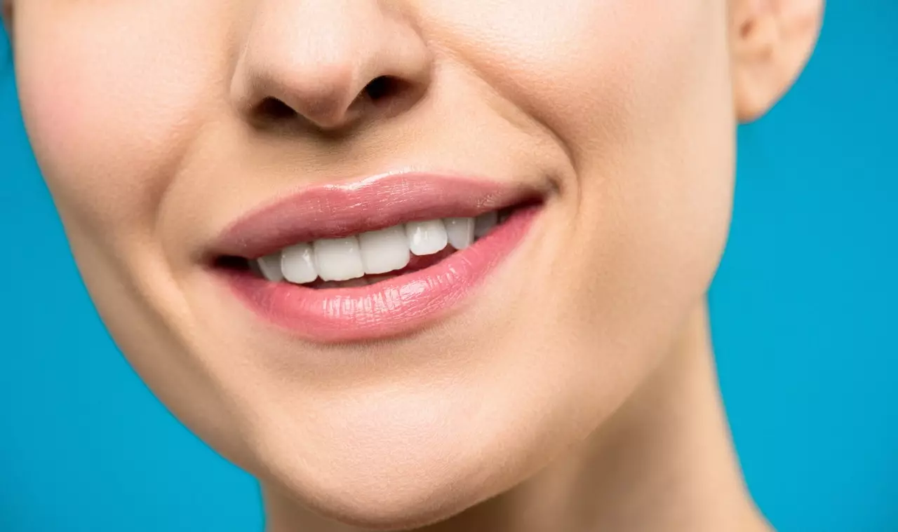 woman posing for a photo with bright white smile