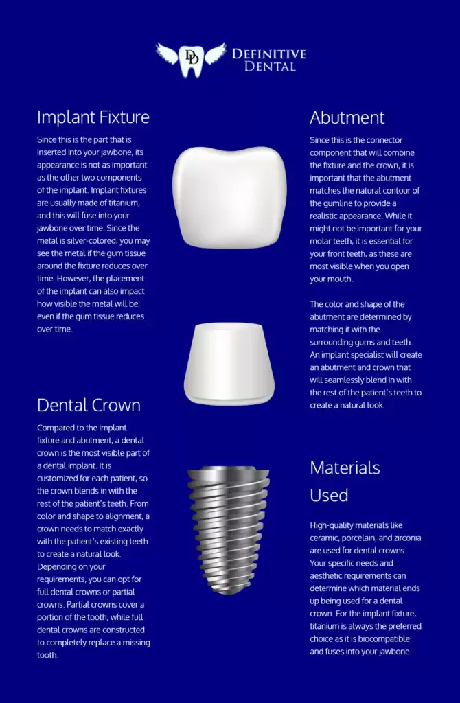 Illustration of how a dental implant can look when fitted