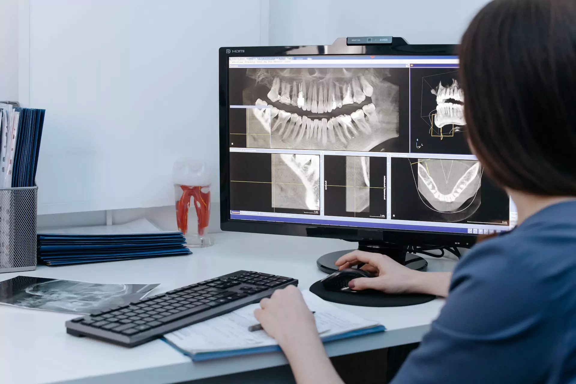 Dental x-rays displayed on a computer